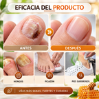 Spray Reparador para Uñas con Veneno de Abeja – 20 ml