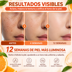 Spray Facial con Vitamina C para Manchas e Hidratación